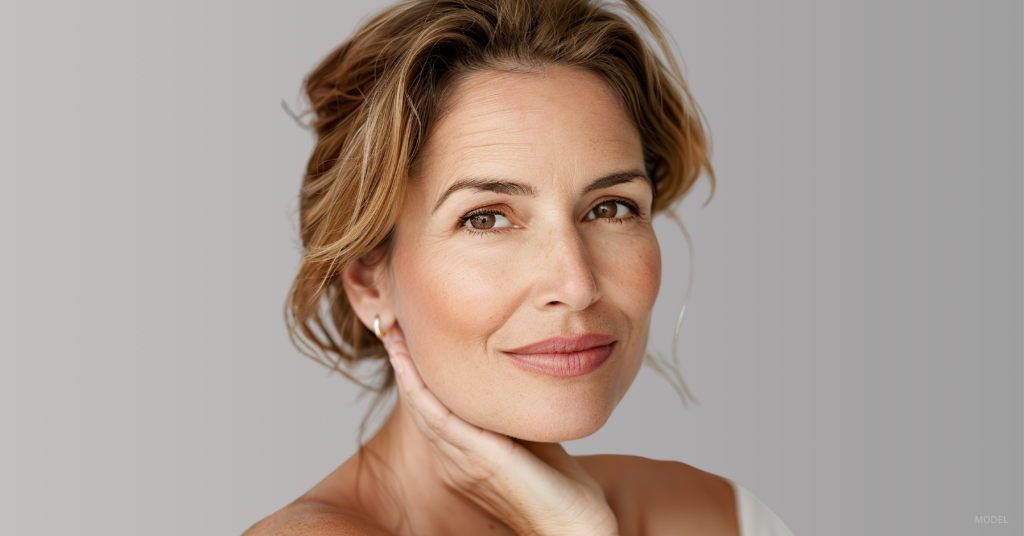 Rejuvenated woman after a facelift. (Model)