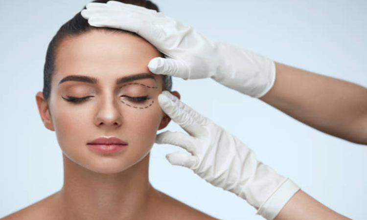 Blepharoplasty Kalamazoo