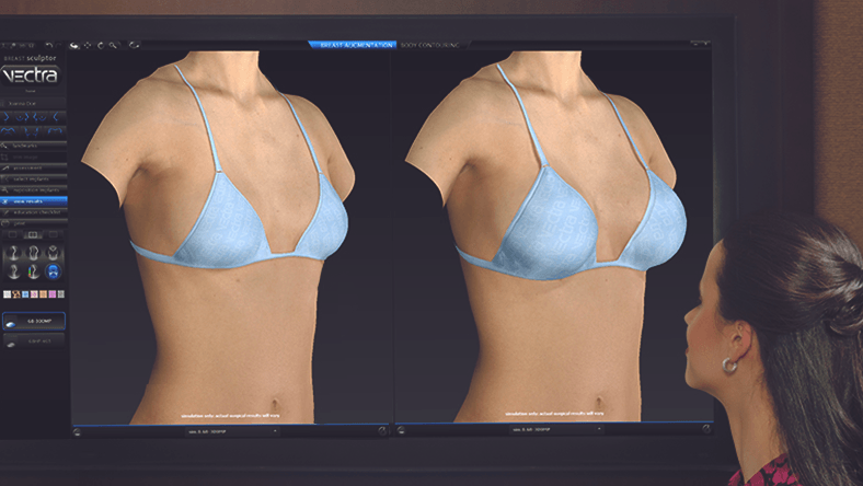 See Your Results Before Surgery with Vectra 3D® Imaging - West