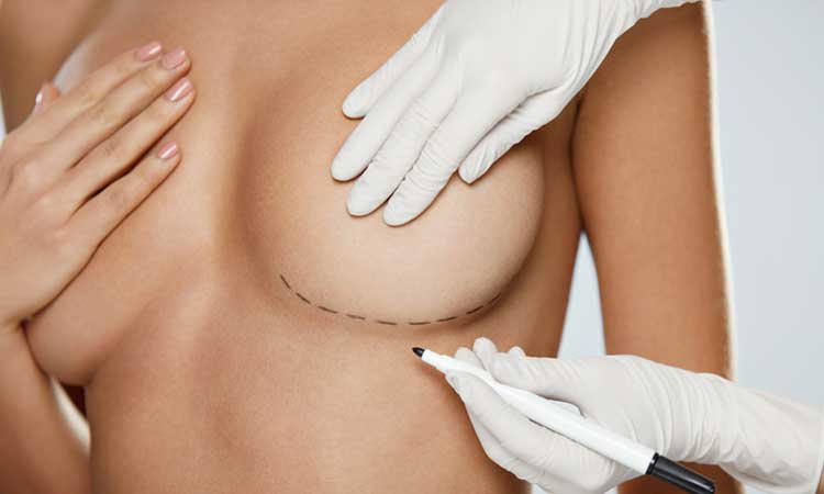 Breast Augmentation Kalamazoo