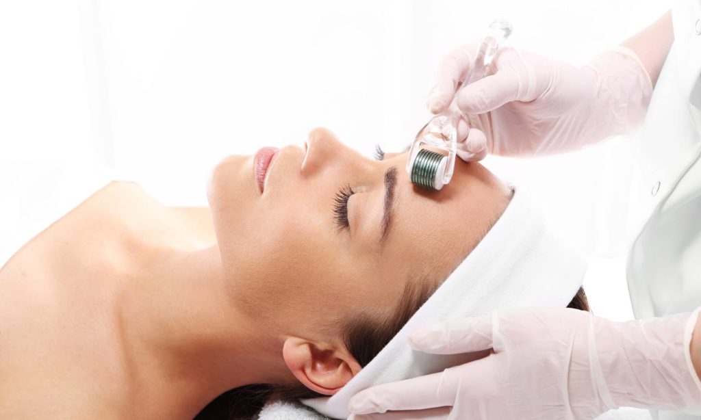 RF Microneedling Kalamazoo